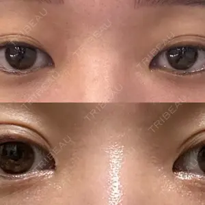 LUHO（ルホ）美容外科口コミ