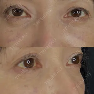藤・ナチュレ美容クリニック 藤・ナチュレ美容クリニック 銀座院口コミ