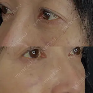 藤・ナチュレ美容クリニック 藤・ナチュレ美容クリニック 銀座院口コミ