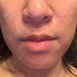 おおかみ美容のクリニックの口コミ