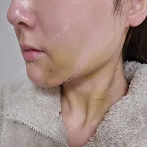 藤・ナチュレ美容クリニック 藤・ナチュレ美容クリニック 銀座院口コミ