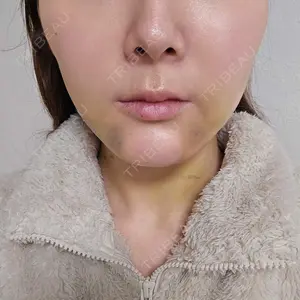 藤・ナチュレ美容クリニック 藤・ナチュレ美容クリニック 銀座院口コミ