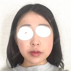 口コミ