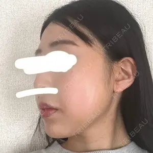 口コミ
