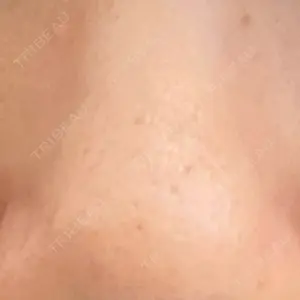 千里中央花ふさ皮ふ科口コミ