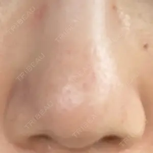 千里中央花ふさ皮ふ科口コミ