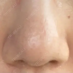 千里中央花ふさ皮ふ科口コミ