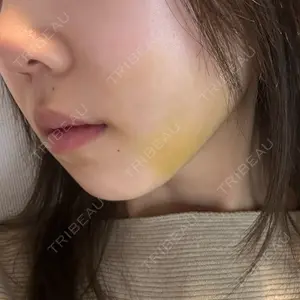 口コミ