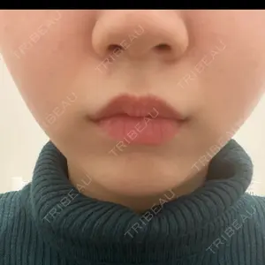 BBClinic BBClinic 銀座口コミ