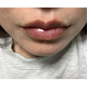口コミ