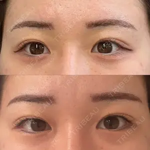 ルーチェクリニック ルーチェクリニック 銀座院口コミ