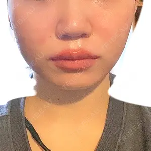 口コミ