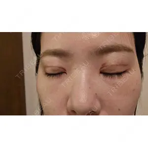 プロミス整形外科口コミ