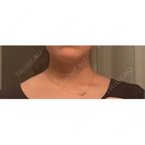 フォンタナクリニック天神口コミ