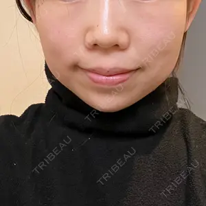 ルラ美容クリニック ルラ美容クリニック 大阪本院口コミ