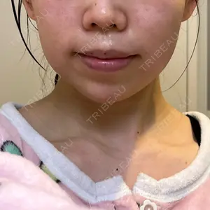 ルラ美容クリニック ルラ美容クリニック 大阪本院口コミ