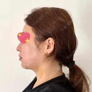 セギム美容整形外科口コミ