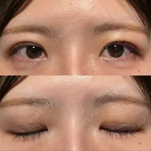 口コミ