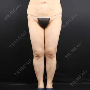 藤・ナチュレ美容クリニック 藤・ナチュレ美容クリニック 銀座院口コミ
