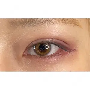 藤・ナチュレ美容クリニック 銀座院の