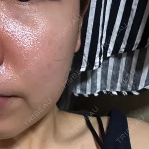 Zetith Beauty Clinic 福岡院口コミ