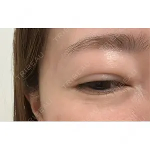 PRO CLINIC プロクリニック 銀座院口コミ