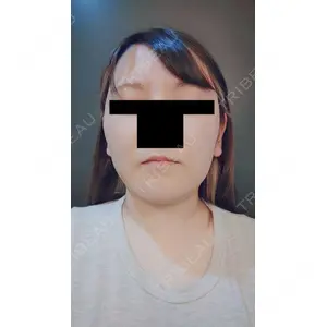 口コミ