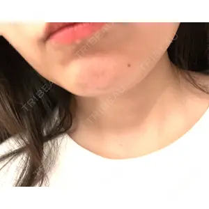口コミ