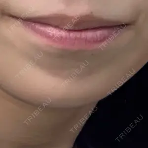 ルラ美容クリニック ルラ美容クリニック 名古屋本院口コミ