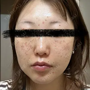 口コミ