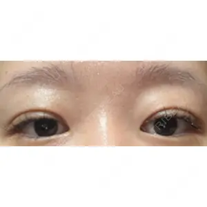 HAAB×DREAM BEAUTY CLINIC 大阪梅田院の
