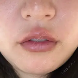 PRO CLINIC プロクリニック 銀座院口コミ