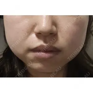 DMTC美容皮膚科 DMTC美容皮膚科 渋谷院口コミ