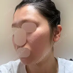 L‘amour clinic Tokyo【ラムールクリニック東京】口コミ