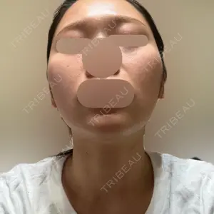 L‘amour clinic Tokyo【ラムールクリニック東京】口コミ