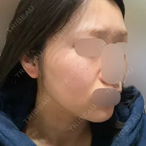 L‘amour clinic Tokyo【ラムールクリニック東京】口コミ