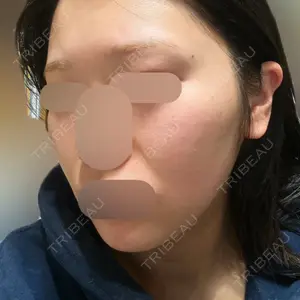L‘amour clinic Tokyo【ラムールクリニック東京】口コミ