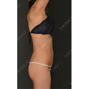 Lipo Clinic omotesandoの