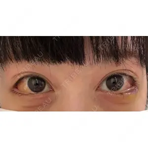 東京BELLEZZAクリニック口コミ