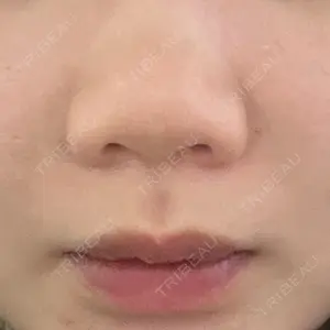 口コミ