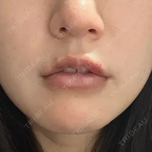 PRO CLINIC プロクリニック 銀座院口コミ