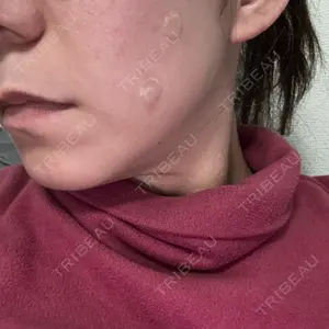エースクリニック 大阪梅田HEPナビオ院の