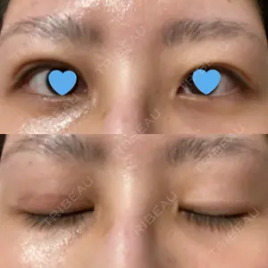 いちのせ形成外科・皮膚科 眼瞼＆フェイスクリニック口コミ