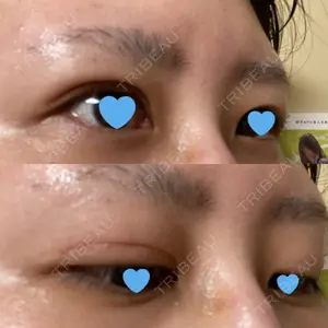 いちのせ形成外科・皮膚科 眼瞼＆フェイスクリニック口コミ