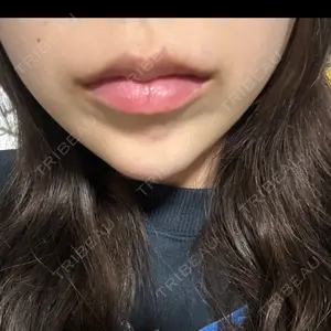 口コミ
