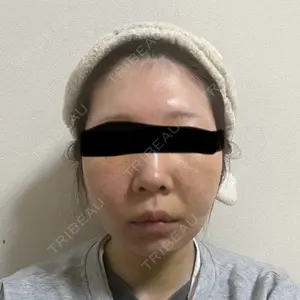 口コミ
