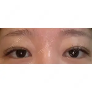 HAAB×DREAM BEAUTY CLINIC 大阪梅田院の