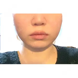 口コミ