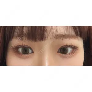 口コミ