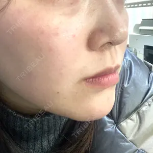 DAILY SKIN CLINIC DAILY SKIN CLINIC 心斎橋院口コミ
